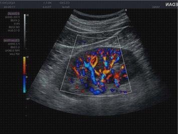 Las mejores acclaris acclaris ax8 ecografo