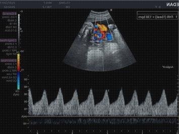 Opiniones de acclaris acclaris ax8 ecografo