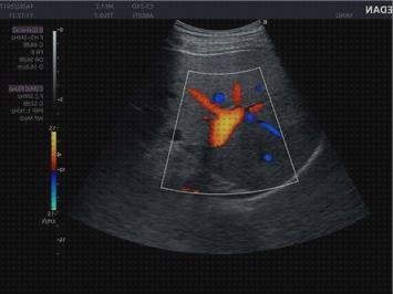 TOP 7 acclaris ax8 ecografo del mundo
