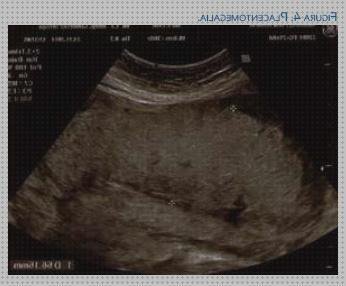 ¿Dónde poder comprar alteraciones alteraciones ecograficas sugestivas de chagas congenito?