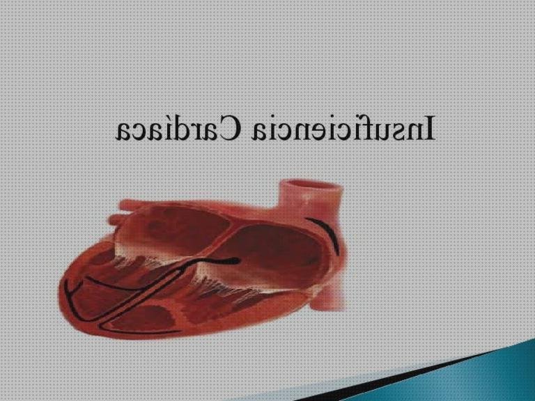 Las mejores alteraciones electrocardiográficas Mas hipertensión pulmonar primaria espirometría Mas biometria oftalmologia lampara de hendidura alteraciones electrocardiograficas en insuficiencia cardiaca