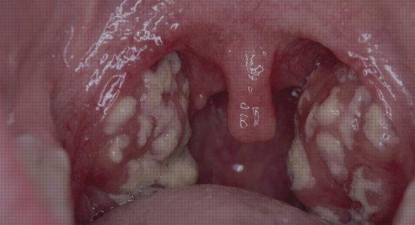 Las mejores Mas apósitos venex Mas diclofenaco apósitos Mas apósitos 25x10 amchafibrin apósitos