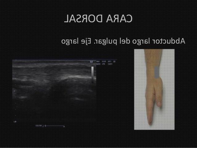 Los mejores 10 Anatomia Ecografica De Las Manos