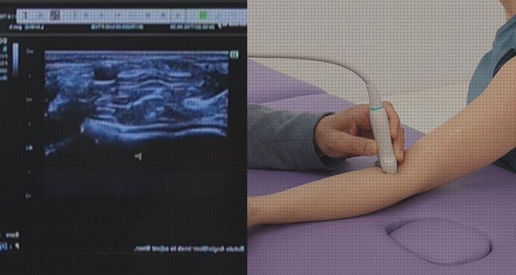 Los 20 Mejores Anatomia Ecografica Del Codos