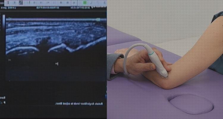 ¿Dónde poder comprar ecografica anatomia ecografica del codo?