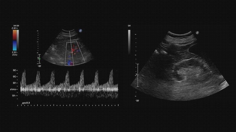 Las mejores marcas de doppler angulos eco doppler