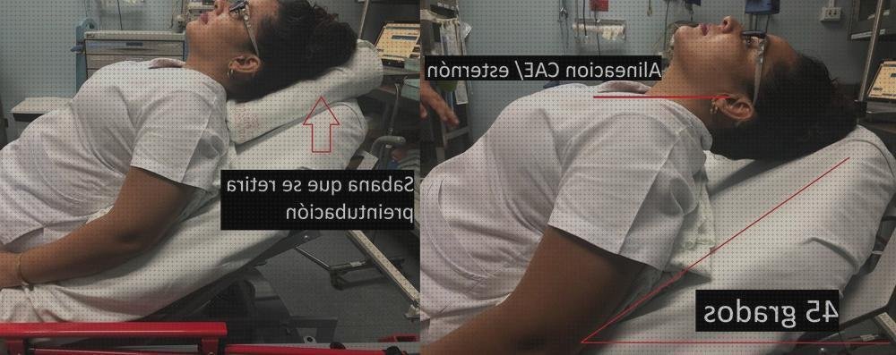 Review de antes de una laringoscopia