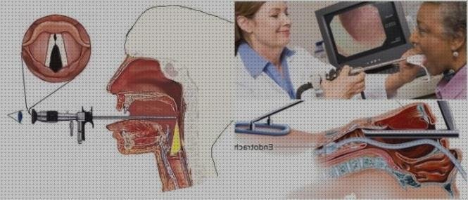 Los mejores 4 Antes De Unas Laringoscopia