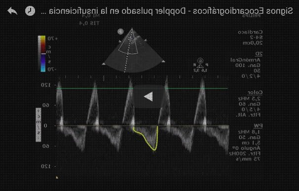 Análisis de los 14 mejores aortica médicos a la venta