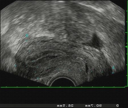 Las mejores marcas de aparatos aparatos de ginecologia para ecografía vaginal
