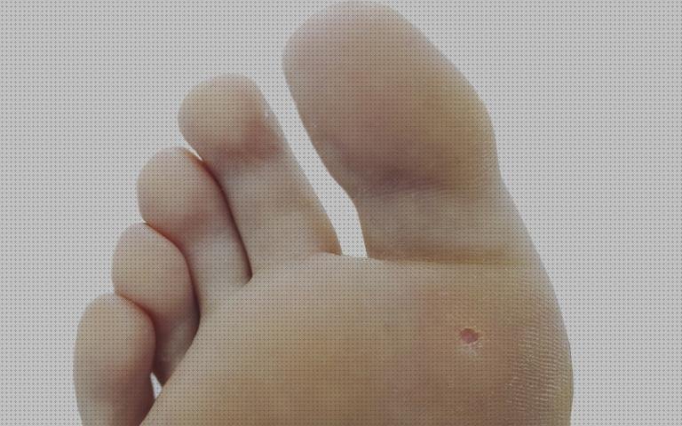 ¿Dónde poder comprar ecografía pies anatomia ecografica displasia de caderas sonda ecografica apósito clavos en los pies?