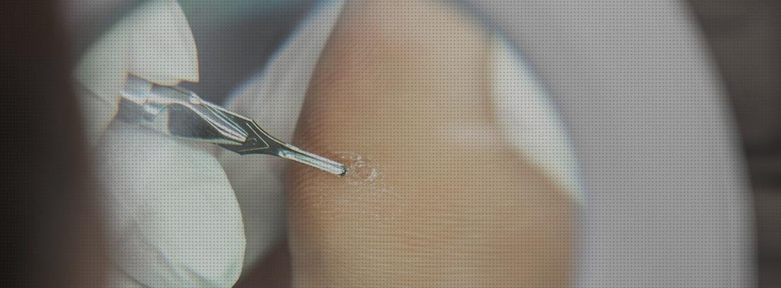 Las mejores marcas de ecografía pies anatomia ecografica displasia de caderas sonda ecografica apósito clavos en los pies