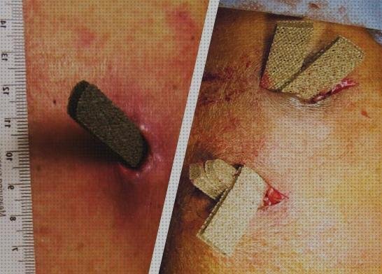 Review de apósito de malla con plata