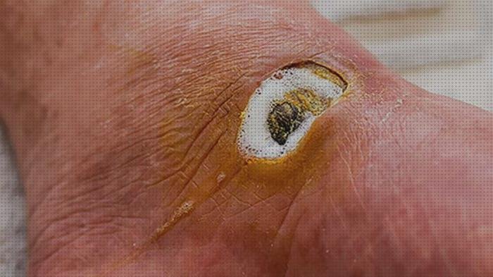 Las mejores apósito plata apósito apósito de plata en caso de infección