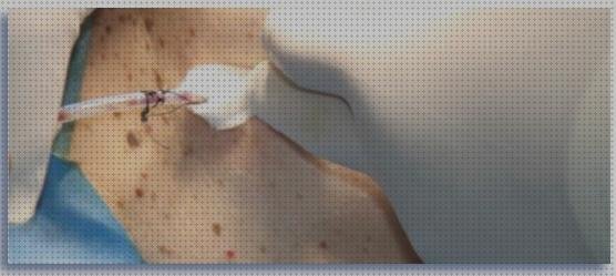 Las mejores marcas de apósito drenaje herida Mas apósito carbono apósito apósito drenaje de herida