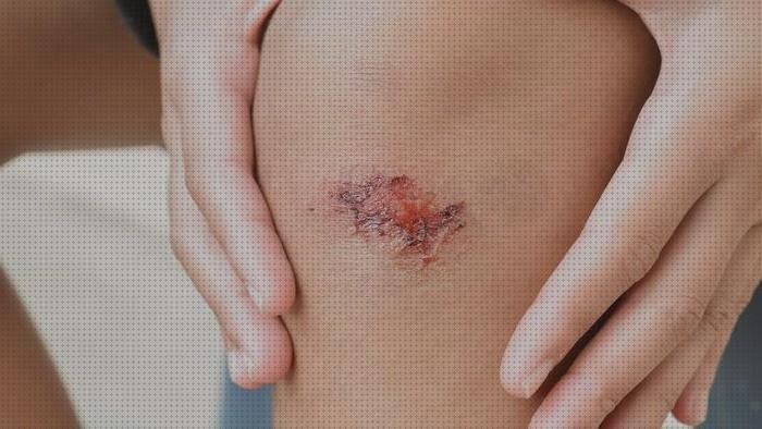 Review de apósito drenaje de herida