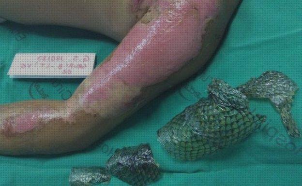 Las mejores marcas de Mas apósito de frio Mas apósito carbono apósito apósito regenerador de piel quemadura