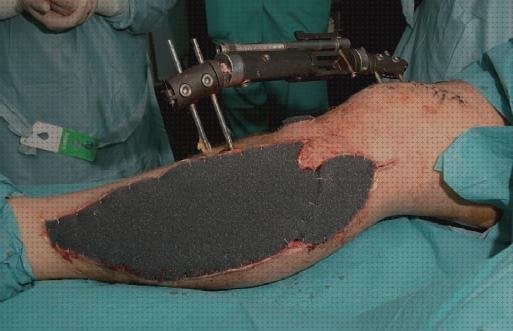 Review de apósito sig