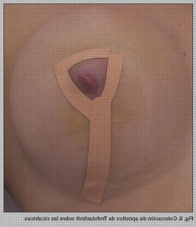 Las mejores marcas de Mas apósitos granos Mas apósitos venex Mas diclofenaco apósitos apósitos areolas cicatriz