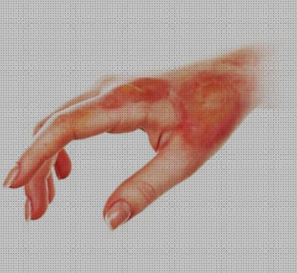 Review de apósitos cicatrizantes y regenerantes