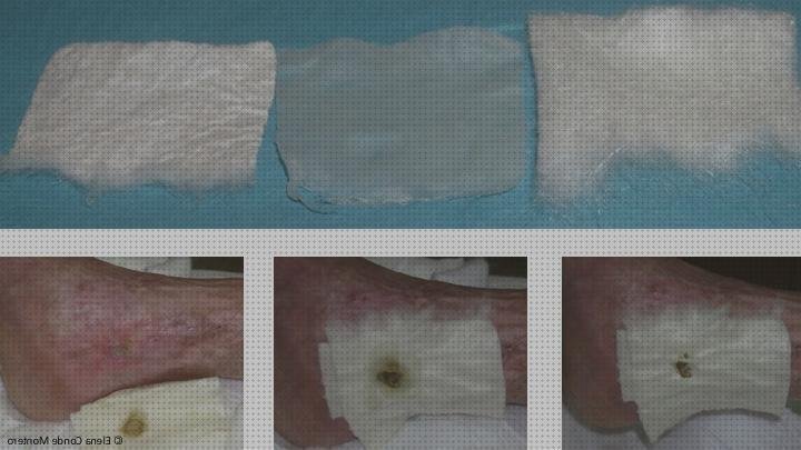 Las mejores apósitos alginato plata apósitos apósitos con alginato de plata