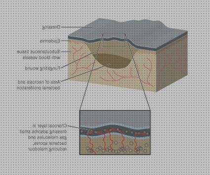 Review de apósitos de plata y carbon