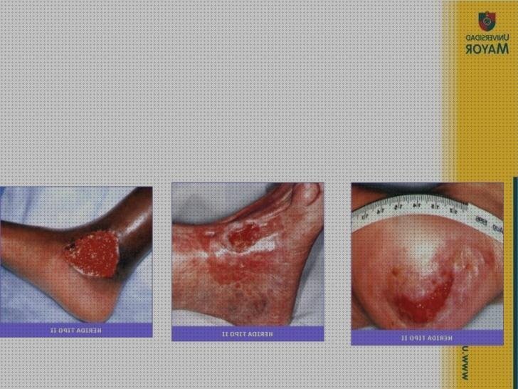 Review de apósitos pasivos e interactivos