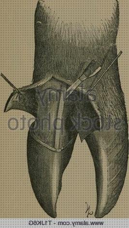 Las mejores apósitos piel apósitos apósitos piel fina de mayores