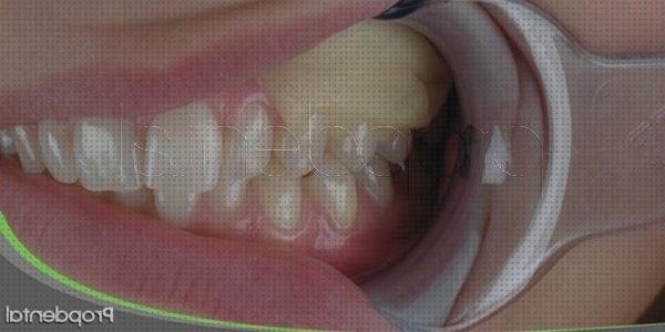 Análisis de los 16 mejores Apósitos Quirurgicos Dentales