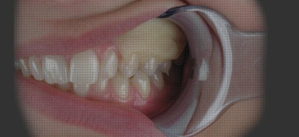 Las mejores apósitos quirurgicos apósitos apósitos quirurgicos periodontales