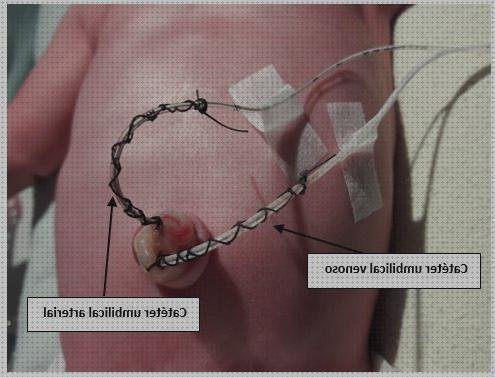 Las mejores marcas de Mas apósitos hemostaticos calcio Mas apósitos granos Mas apósitos venex apósitos vía umbilical