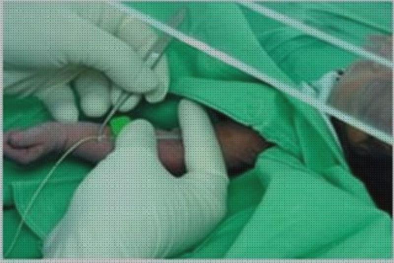 Review de apósitos vía umbilical