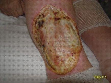 ¿Dónde poder comprar apósito argencoat Mas apósito callicida Mas tensiometro digital farmacity argencoat apósito?