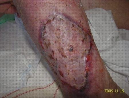 Las mejores marcas de apósito argencoat Mas apósito callicida Mas tensiometro digital farmacity argencoat apósito