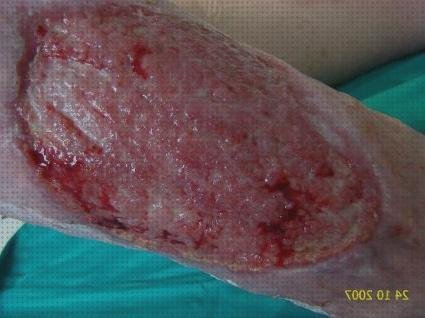 Las mejores apósito argencoat Mas apósito callicida Mas tensiometro digital farmacity argencoat apósito