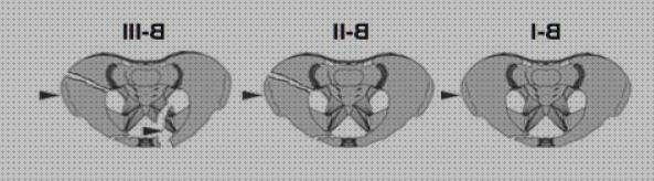 Las mejores marcas de aritraq laringoscopio