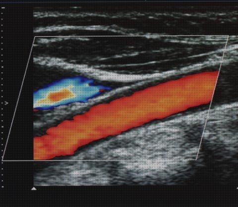 Análisis de las 8 mejores arterias médicos