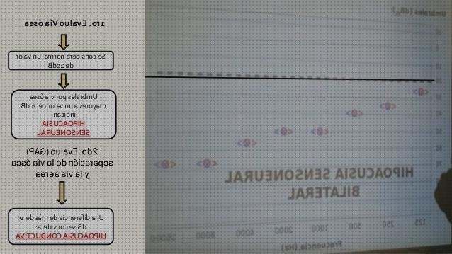 Las mejores marcas de Mas mochila de emergencia ante desastres Mas hipertensión pulmonar primaria espirometría Mas biometria oftalmologia lampara de hendidura audiometr frecuencia db