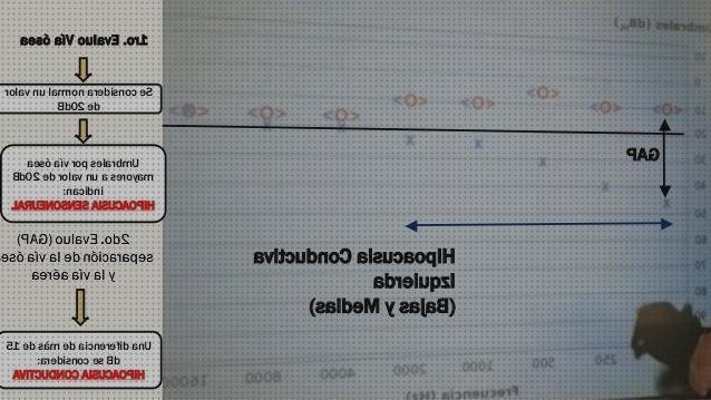 Review de audiometr frecuencia db