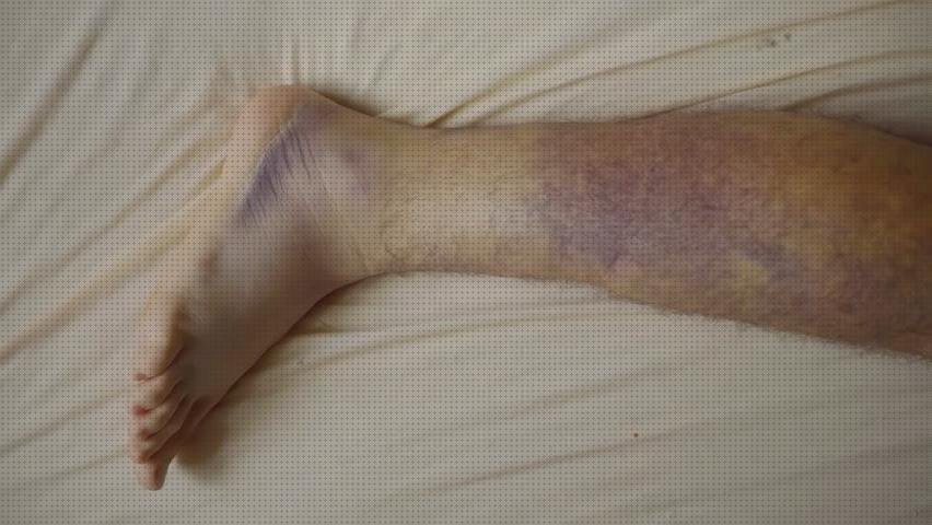 Las mejores Mas vendas postoperatorias Mas vendas conan Mas vendas medilast badbroken vendas