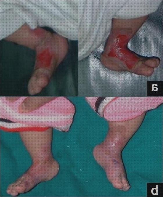 Las mejores marcas de Mas apósitos venex Mas diclofenaco apósitos Mas apósitos 25x10 begune apósitos