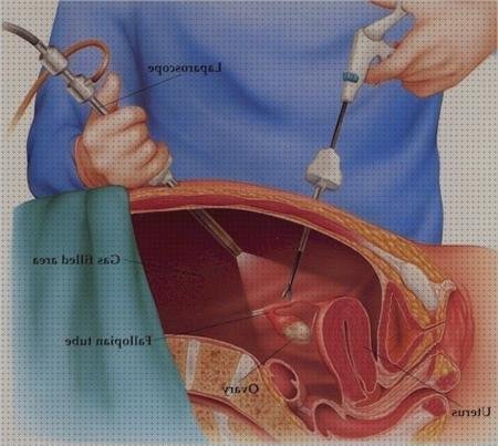¿Dónde poder comprar cirugia bisturi bisturi electrico cirugia abdominal?