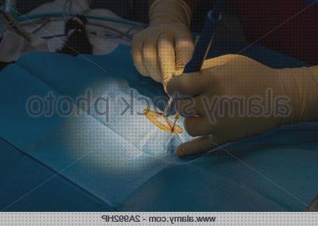 Las mejores marcas de cirugia bisturi bisturi electrico cirugia abdominal