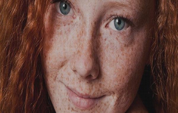 Las mejores nevus