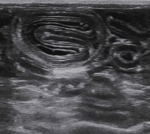 ¿Dónde poder comprar ecograficas capas ecograficas intestino delgado?