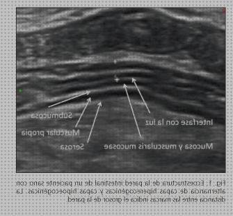 Opiniones de las 3 mejores Capas Ecograficas Intestinos Delgados