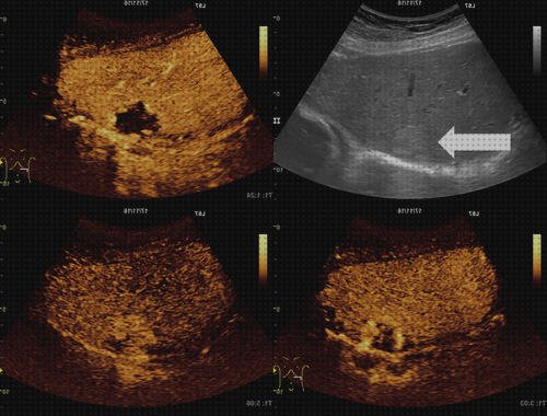 Análisis de los 18 mejores contrastes ecograficos