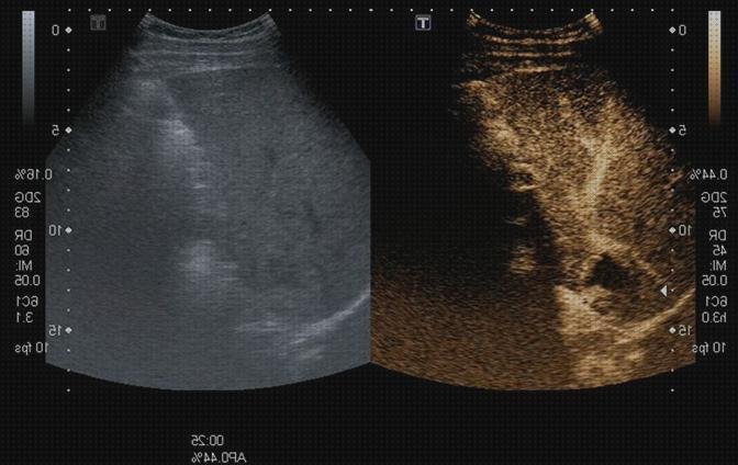 Las mejores marcas de ecograficos contrastes ecograficos