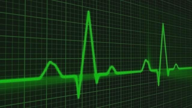 ¿Dónde poder comprar corazon?