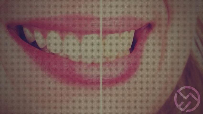 ¿Dónde poder comprar blanqueador crema dental blanqueador y irrigador?